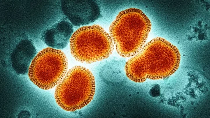 SC identifica e monitora 17 casos de Gripe K; entenda o que é e como se proteger