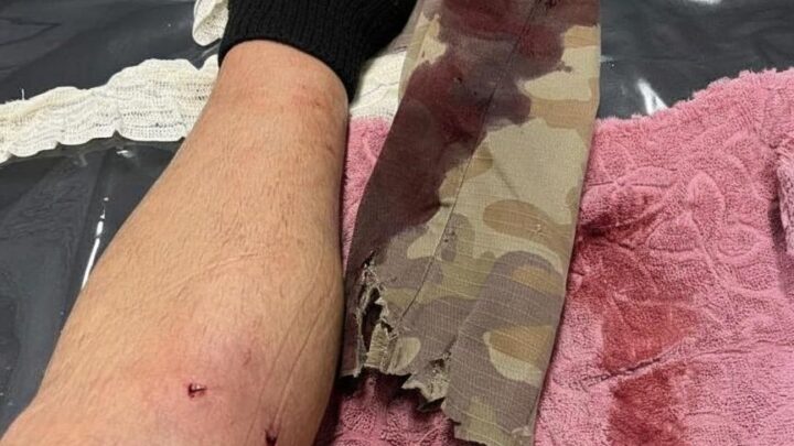 Cachorro morde policial durante ocorrência que termina com recaptura de foragido em Herval d’Oeste