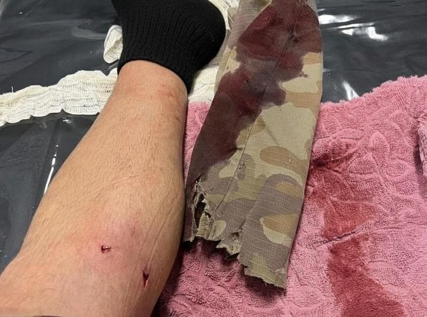 Cachorro morde policial durante ocorrência que termina com recaptura de foragido em Herval d’Oeste